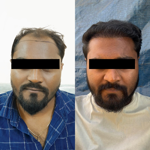 Untitled design (13)