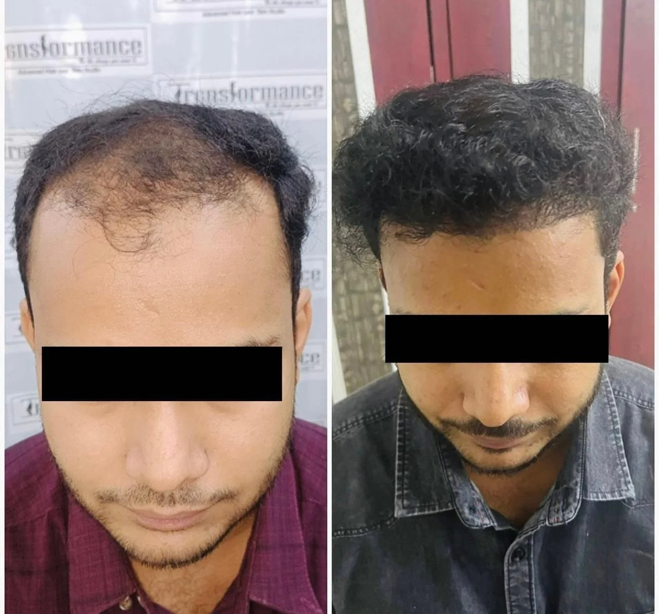 Hair treatment result